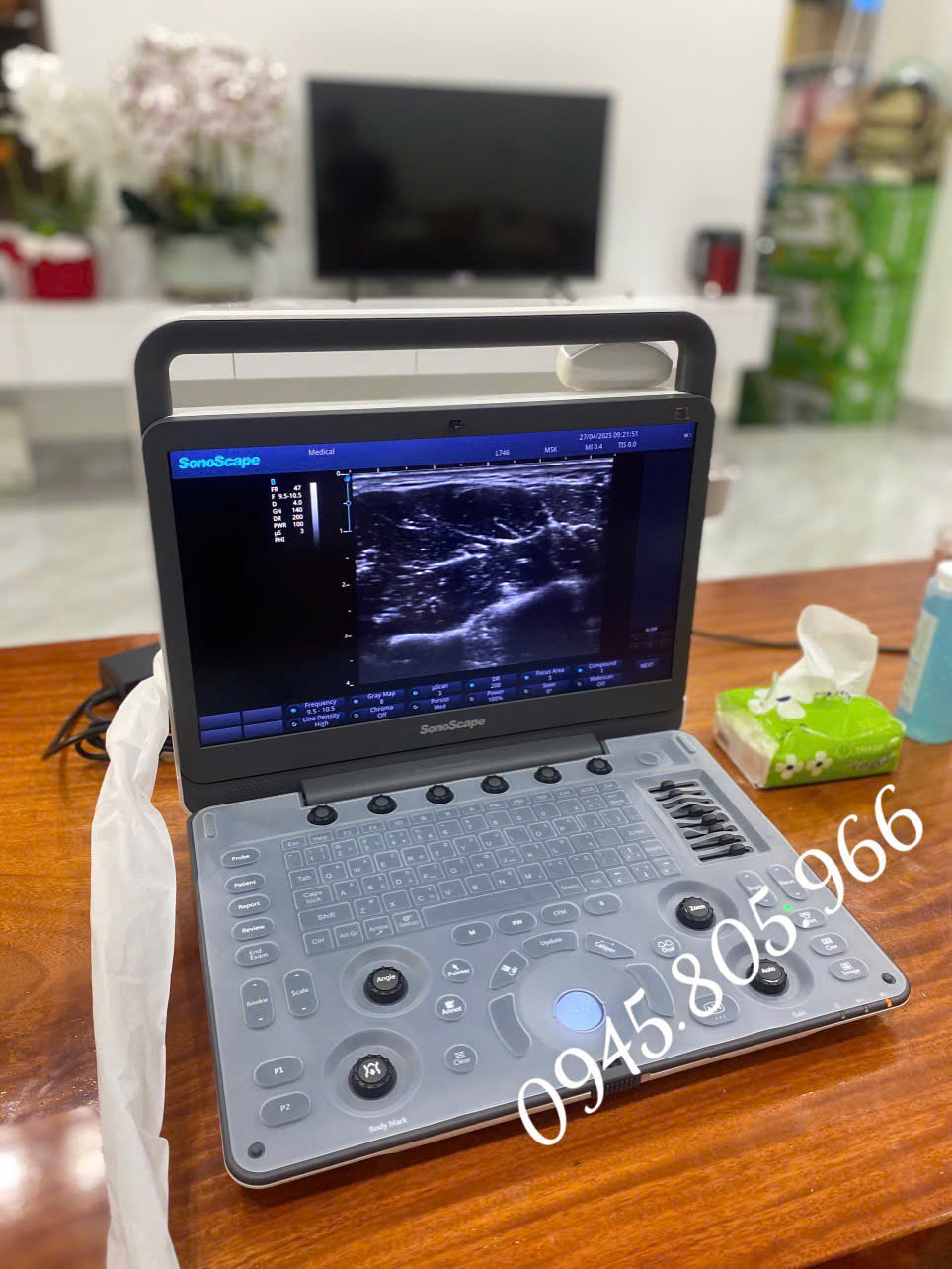 Máy siêu âm cơ xương khớp